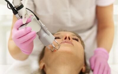 Age spots and fine wrinkles improved with laser therapy