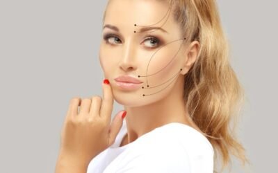 Loose skin around the eyes lifted with PDO threads