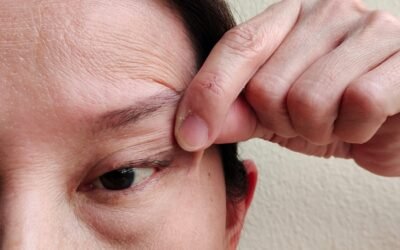 Non-surgical facelift with Ultherapy for sagging skin